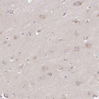 Anti-DIMT1 antibody produced in rabbit