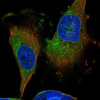 Anti-DIRAS3 antibody produced in rabbit