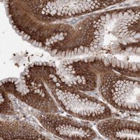 Anti-DIS3L2 antibody produced in rabbit