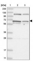 Anti-DIS3L2 antibody produced in rabbit
