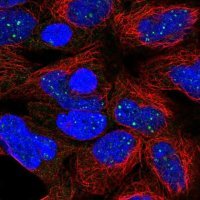 Anti-DISP1 antibody produced in rabbit