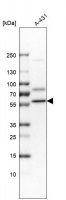 Anti-DKC1 antibody produced in rabbit 
