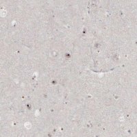 Anti-DKC1 antibody produced in rabbit HPA000166-100UL