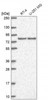 Anti-DLG3 antibody produced in rabbit
