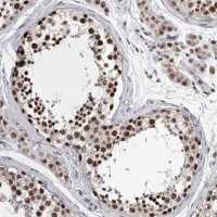 Anti-DMTF1 antibody produced in rabbit 