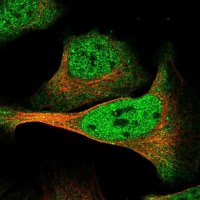 Anti-DMTF1 antibody produced in rabbit 