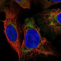 Anti-DNAAF2 antibody produced in rabbit 
