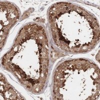 Anti-DNAJA4 antibody produced in rabbit 