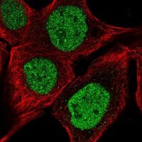 Anti-DNAJB6 antibody produced in rabbit HPA058593-100UL