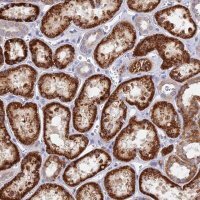 Anti-DNAJC16 antibody produced in rabbit 