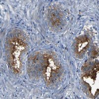 Anti-DNAJC5 antibody produced in rabbit