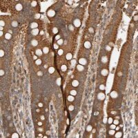 Anti-DNAJC7 antibody produced in rabbit HPA023015-100UL