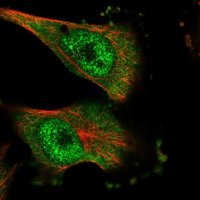 Anti-DNAJC7 antibody produced in rabbit HPA023015-100UL