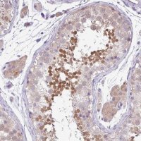 Anti-DNAL1 antibody produced in rabbit 
