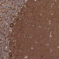 Anti-DOCK3 antibody produced in rabbit