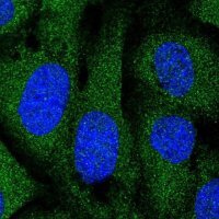 Anti-DOCK6 antibody produced in rabbit 