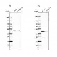 Anti-DOK7 antibody produced in rabbit 