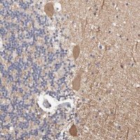 Anti-DOPEY1 antibody produced in rabbit 