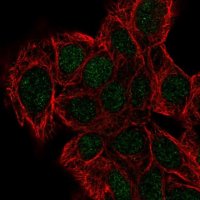 Anti-DPH2 antibody produced in rabbit 