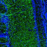 Anti-DPP6 antibody produced in rabbit HPA050509-100UL