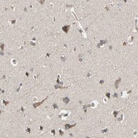 Anti-DPP8 antibody produced in rabbit