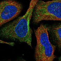 Anti-DPP9 antibody produced in rabbit 