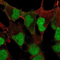 Anti-DPPA4 antibody produced in rabbit 