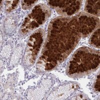 Anti-DPY19L1 antibody produced in rabbit