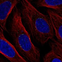 Anti-DPY19L1 antibody produced in rabbit