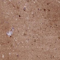Anti-DPYSL4 antibody produced in rabbit HPA049066-100UL