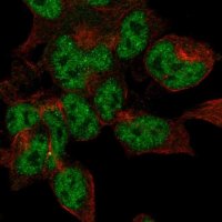 Anti-DPYSL5 antibody produced in rabbit HPA072387-100UL