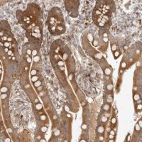 Anti-DSCC1 antibody produced in rabbit HPA023780-100UL