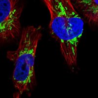 Anti-DSCR3 antibody produced in rabbit 