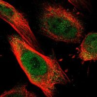 Anti-DSE antibody produced in rabbit 