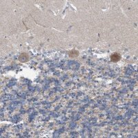 Anti-DST antibody produced in rabbit 