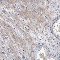 Anti-DST antibody produced in rabbit 