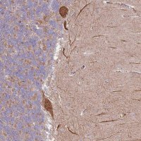 Anti-DTD2 antibody produced in rabbit 