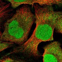 Anti-DTL antibody produced in rabbit 