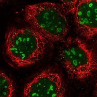 Anti-DTWD1 antibody produced in rabbit 