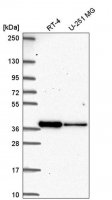 Anti-DTWD2 antibody produced in rabbit 