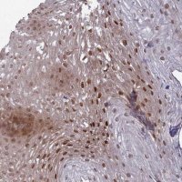 Anti-DTX2 antibody produced in rabbit