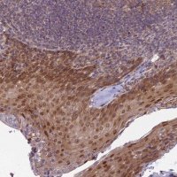 Anti-DTX2 antibody produced in rabbit