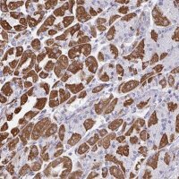 Anti-DTX3 antibody produced in rabbit 