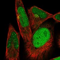 Anti-DTX3 antibody produced in rabbit 