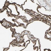 Anti-DTX3L antibody produced in rabbit 