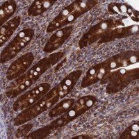 Anti-DTYMK antibody produced in rabbit 