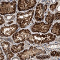 Anti-DUSP10 antibody produced in rabbit 
