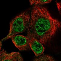 Anti-DUSP10 antibody produced in rabbit 