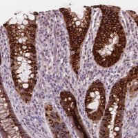 Anti-DUSP16 antibody produced in rabbit
