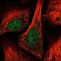 Anti-DUSP16 antibody produced in rabbit